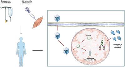 Adeno-Associated Virus (AAV)-Mediated Gene Therapy for Duchenne Muscular Dystrophy: The Issue of Transgene Persistence